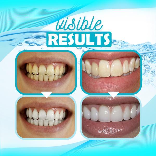 NASSMEI dents blanchissant Mousse dentifrice dentaire